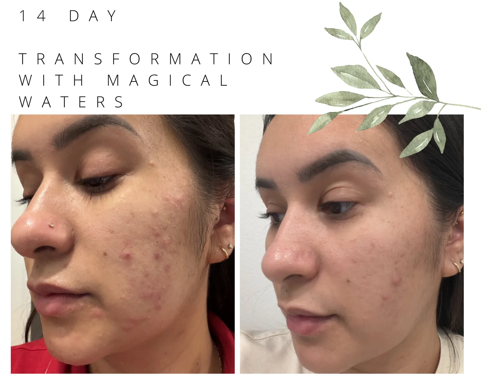 14-Day Skin Transformation
