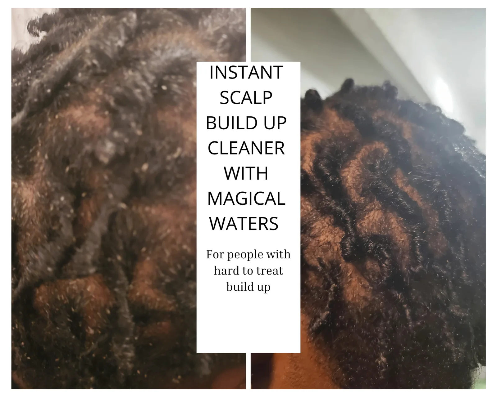 Instant Scalp Build-Up Cleaner